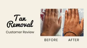 Yeka Tan Removal Oil - Our customer apply Yeka Golden Glow Skin Oil on their hands to get rid of the tan!