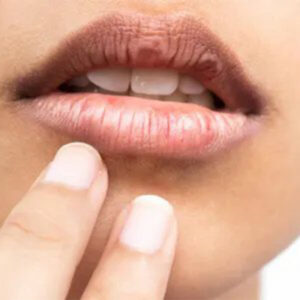 mackup lip pigmentation