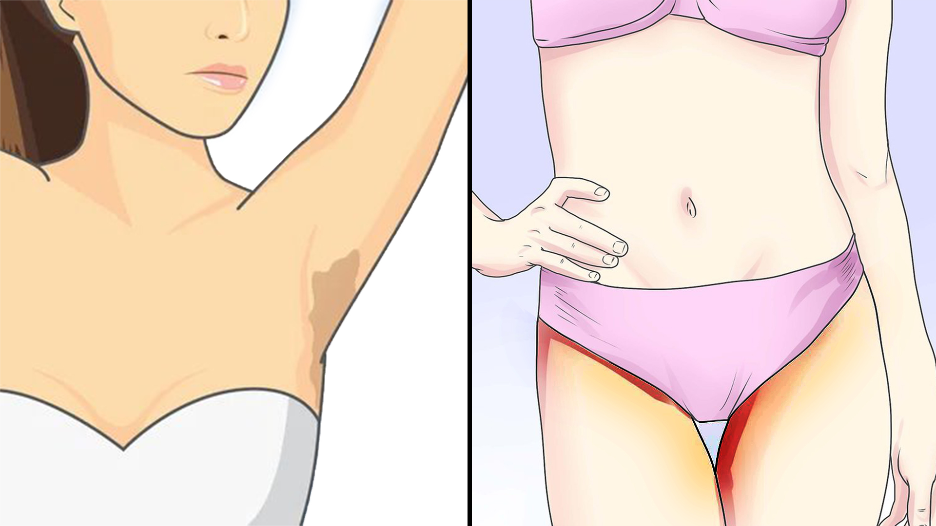 The Down Low Inner Thigh Serum - Helps Dark Spots On Bikini Area & Inner  Thighs