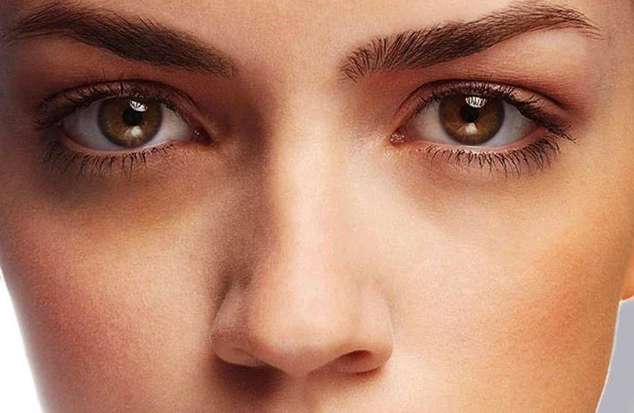 5 Surprising Dark Circles Removal Hacks Yekacosmetics