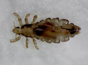 5 Easy and Effective ways to Remove Head Lice Quickly - Yekacosmetics